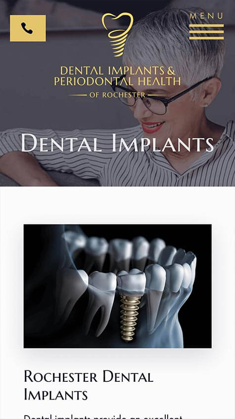 Dental Implants & Periodontal Health Responsive Design